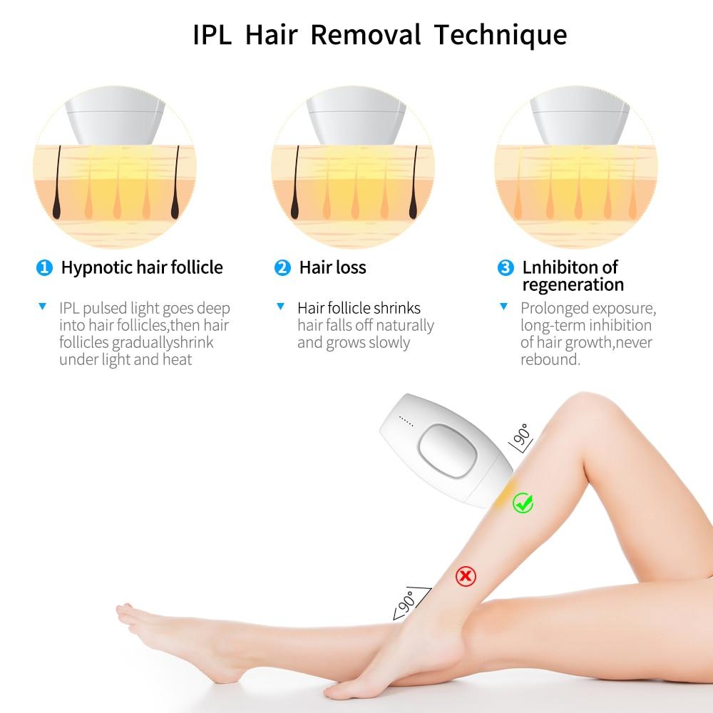 Forever Smooth - IPL Hair Removal